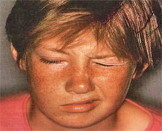 TİKLERİN KİŞİLİK ÖZELLİKLERİ