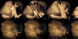 İşte sigaranın bebeklere etkisi