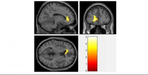 Semazenlerin beyinleri nasıl çalışıyor