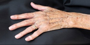 Kadınlarda kalp krizi riskini artıran gen